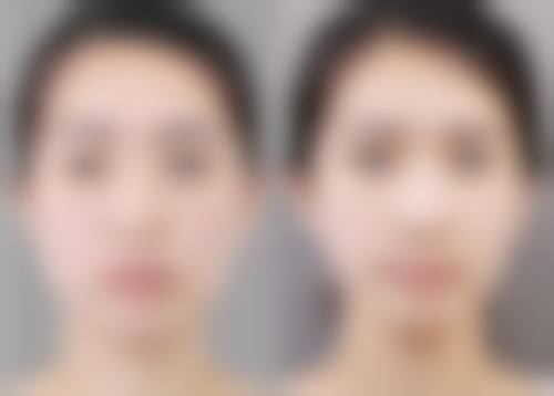 海城市天使整形医院特色项目及技术优势