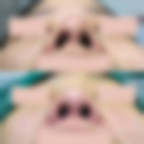 北京国内人民解放军总装后勤部医学整形中 心医院整形科怎么样求美者反馈