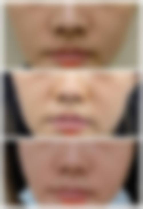 北京国内人民解放军总装后勤部医学整形中 心医院整形科怎么样医生团队实力