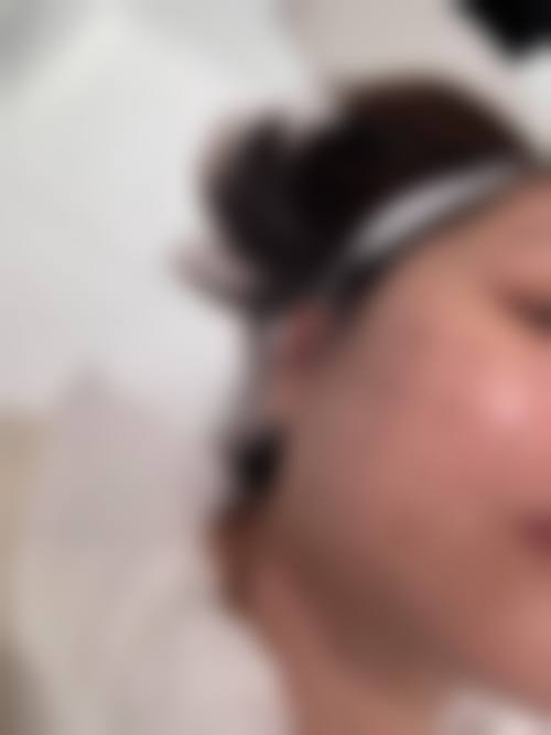 艾泽医生特色技术：个性化定制美丽