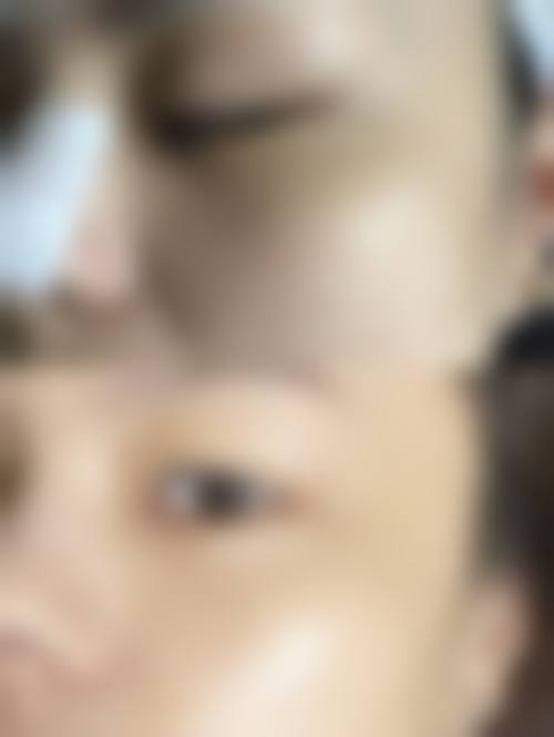 旁娟医生擅长的领域