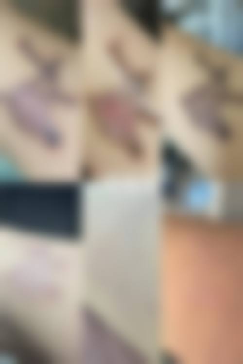 石嘴山市第二人民医院烧伤整容中 心怎么样求美者反馈