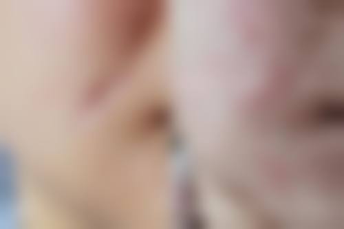 石嘴山市第二人民医院烧伤整容中 心怎么样来院路线