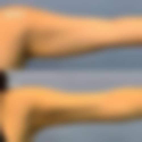 段桃梅医生的精良技术加持