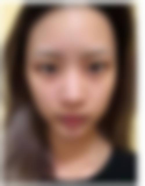 韩国DB整形外科怎么样求美者反馈