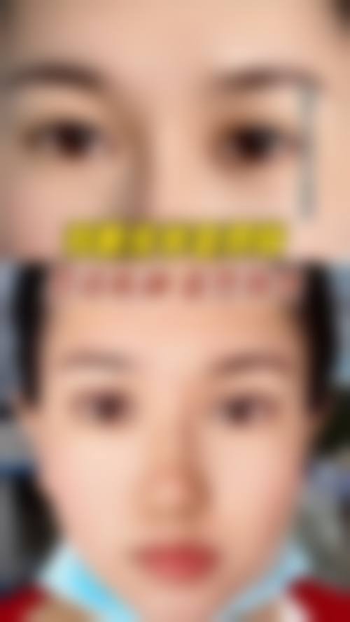 杭州冰美医疗美容医院价格收费