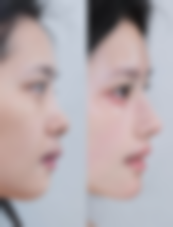 吴昌铉医生的特色技术与成功实例