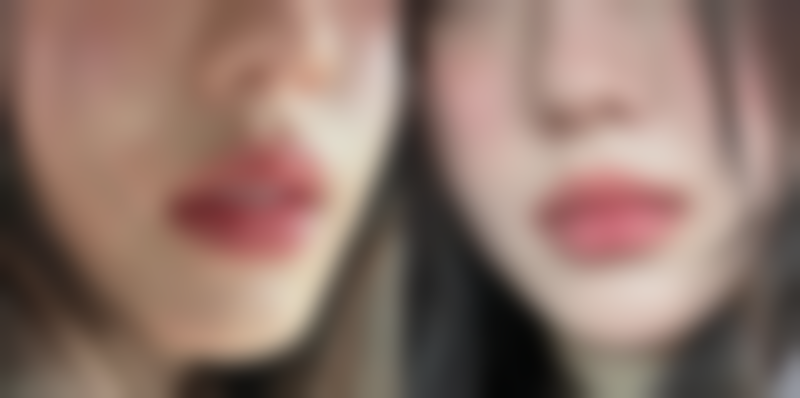 南京美好尉来整形医院怎么样特色项目及技术优势