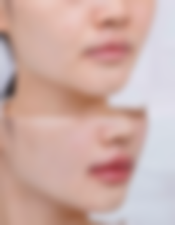 王晓梅医生助力患者实现美丽蜕变