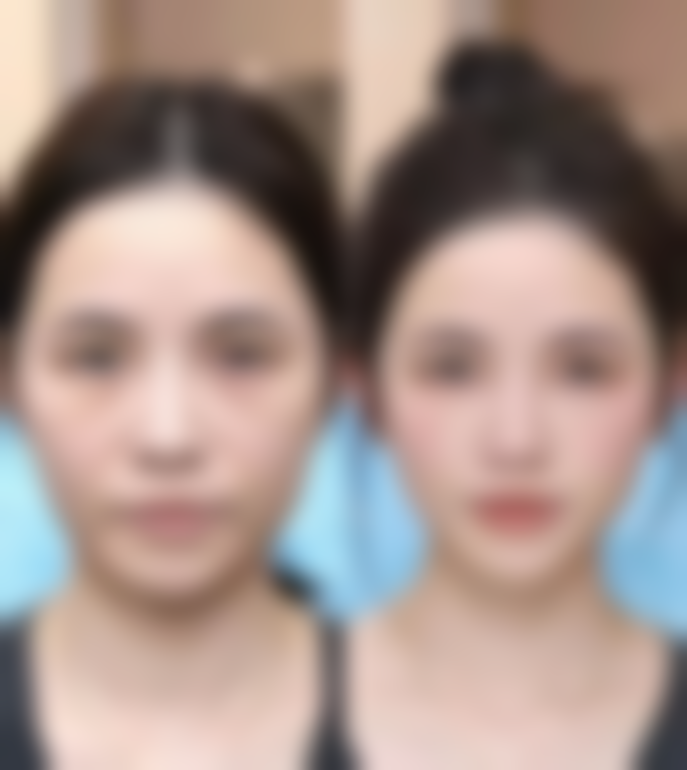 南京美好尉来整形医院怎么样医生团队实力