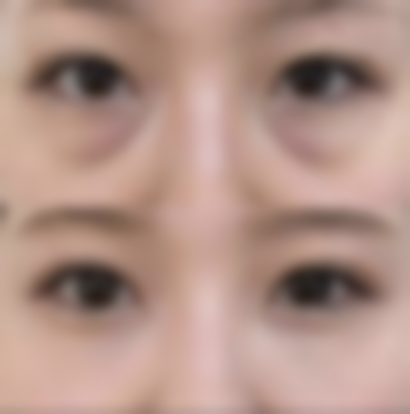 保定佰兰医疗美容医院怎么样来院路线