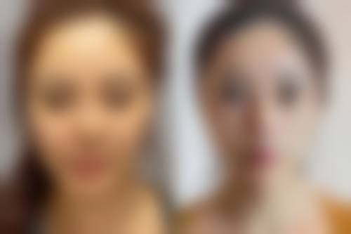 昭通韩御熙美医疗美容门诊部怎么样价格收费