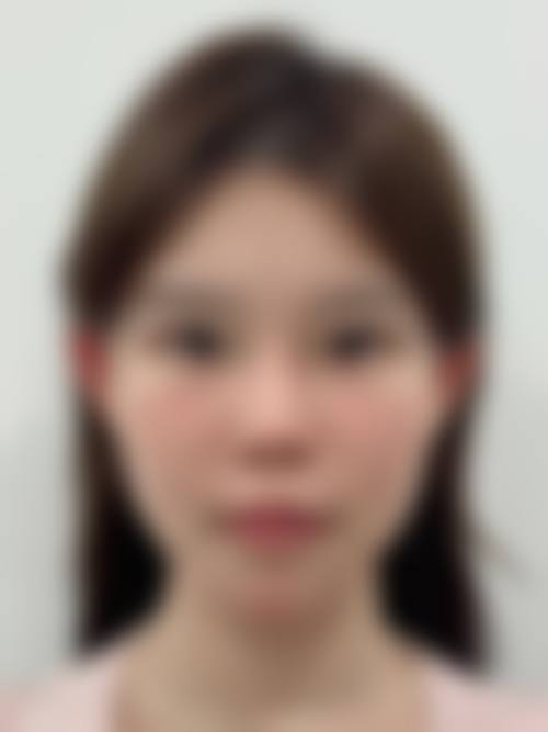 阜阳黛莱美医疗美容医院求美者反馈