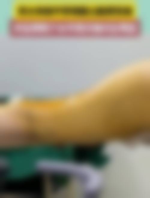 北京丽扬整形美容医院求美者反馈