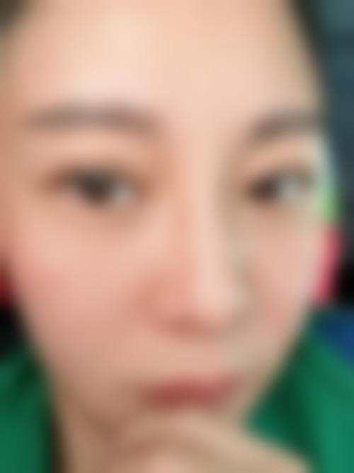 广西自治区人民医院整形美容激光中 心价格收费