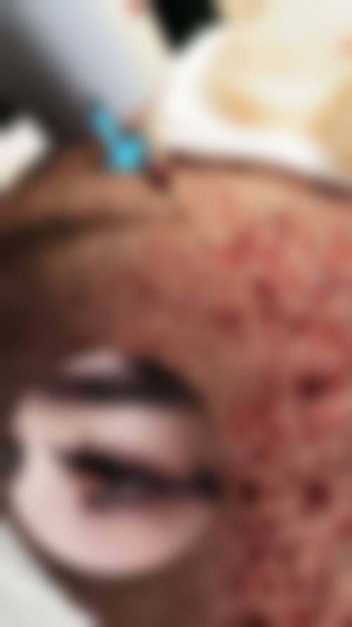 广西自治区人民医院整形美容激光中 心特色项目及技术优势