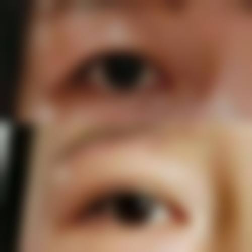 傅凤英医生助力的变得更美实例