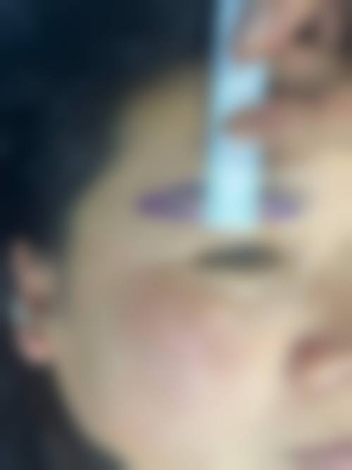 傅凤英医生的价格优势项目