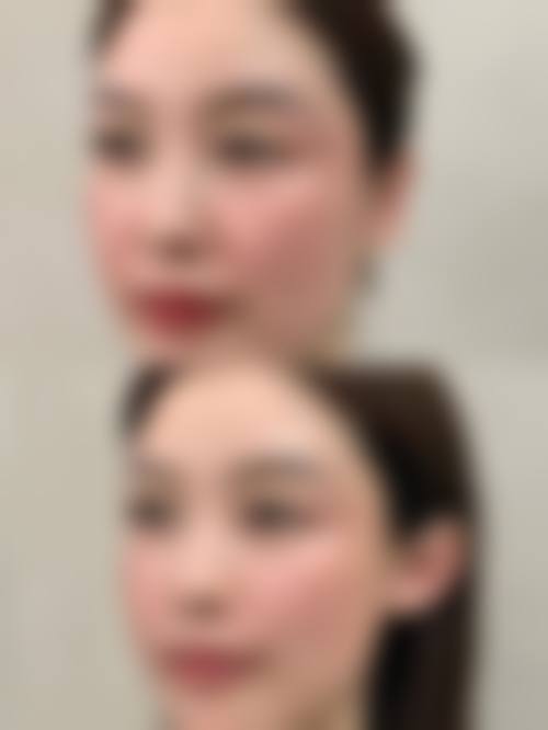 史绯绯医生:精良的激光美容技术