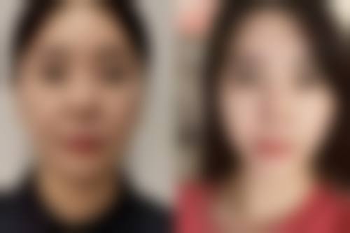 香港SWISSOBeautyExpert整形怎么样特色项目及技术优势