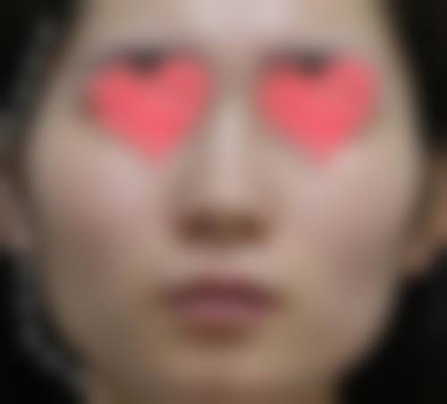 傅凤英医生助您开启美丽之旅