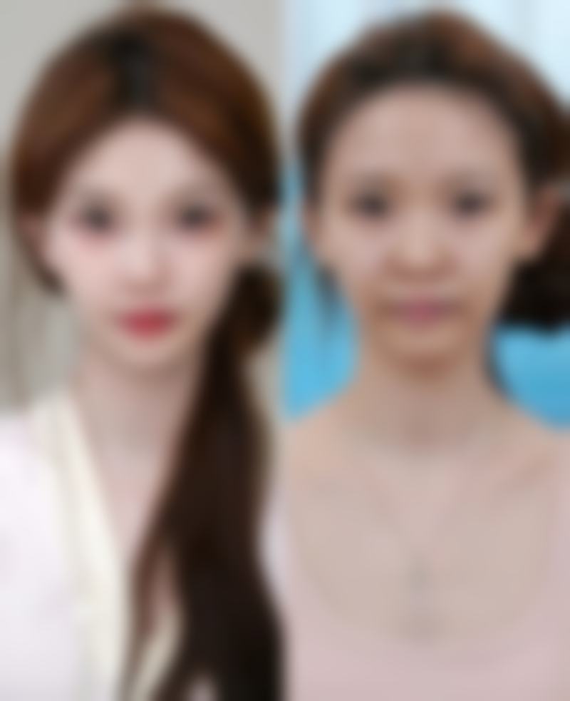 史绯绯医生:特色项目技术亮点