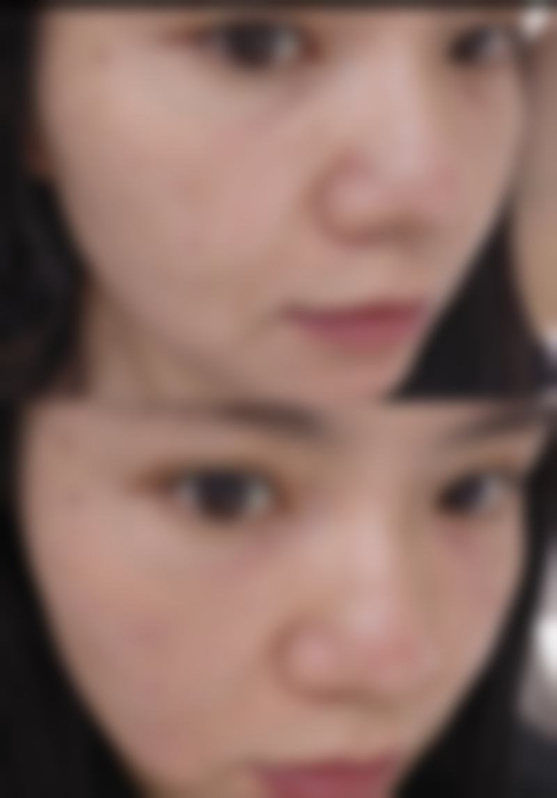 深圳伊然美医疗美容求美者反馈