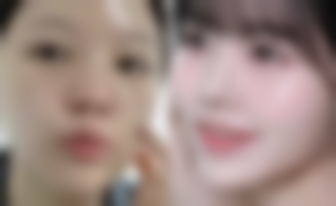 北京慈康医院整形科求美者反馈