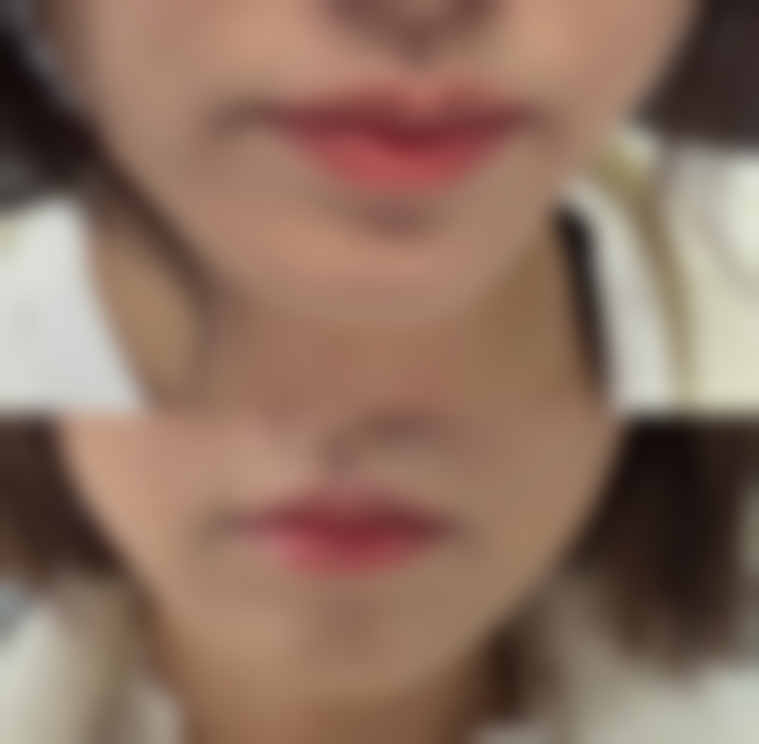 郑州润盛禾医疗美容诊所求美者反馈