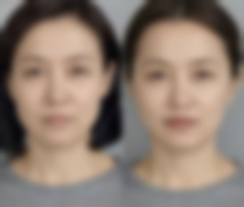 东莞市星辰花医疗美容门诊怎么样特色项目及技术优势