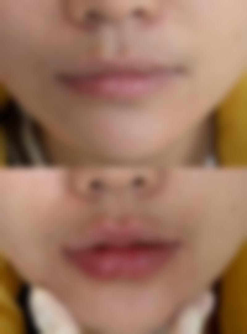 深圳悦她医疗美容整形医院来院路线