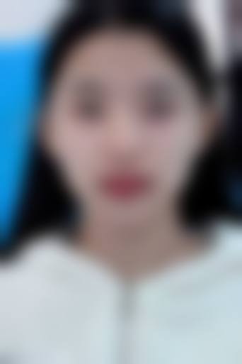 李德延医生的特色技术