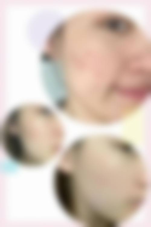 厦门云艺美整形外科门诊部怎么样特色项目及技术优势