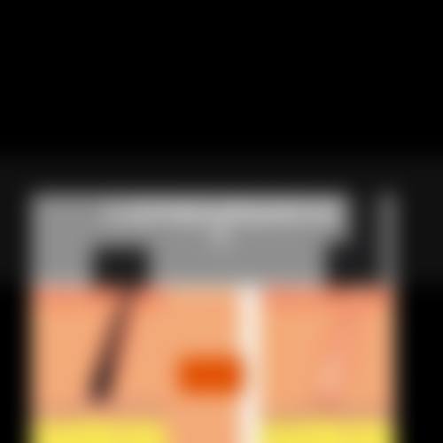 新生植发国内连锁（合肥分店）怎么样价格收费