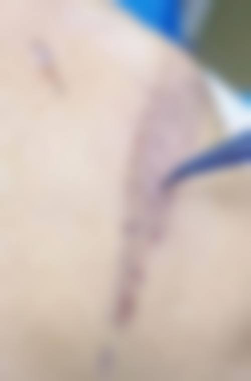 新生植发国内连锁（合肥分店）怎么样基本信息