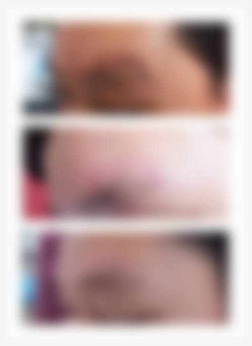 新疆高丽汉白医疗整形美容医院特色项目及技术优势