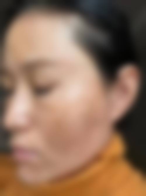 江西艺和医疗美容门诊部价格收费