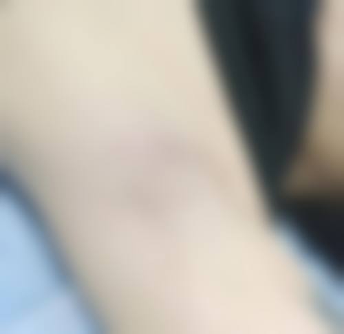 青岛长江医院整形外科求美者反馈