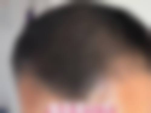 广州华美医疗整形美容医院求美者反馈