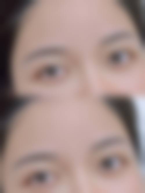 厦门云艺美整形外科门诊部怎么样价格收费