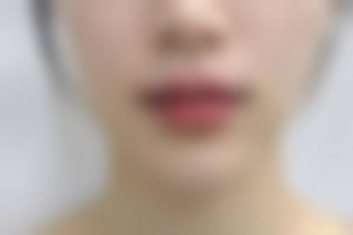 成都金牛秉安堂中医整形门诊部求美者反馈