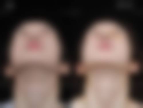 北京丰台医院整形美容科价格收费