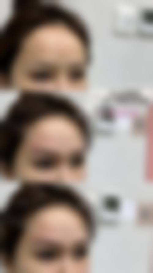 史绯绯医生的技术优势