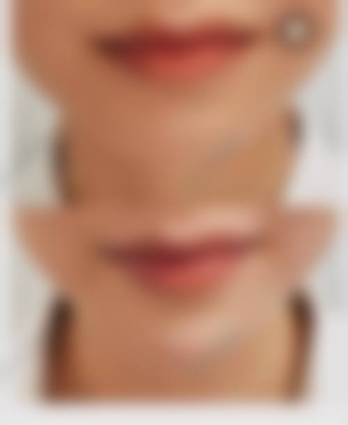 李德延医生的特色技术