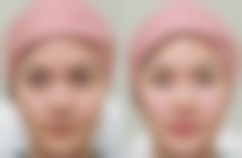 唐山张小熊医疗美容来院路线