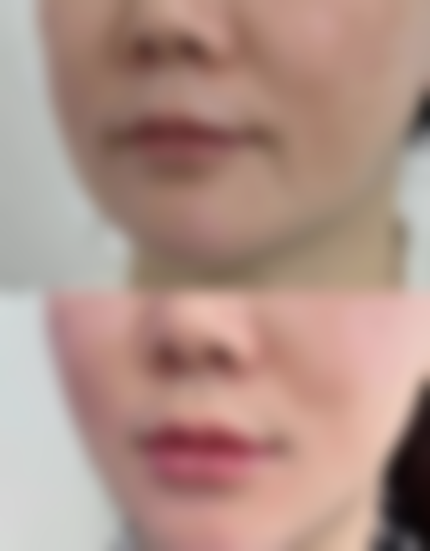 十堰淑美整形医院怎么样求美者反馈