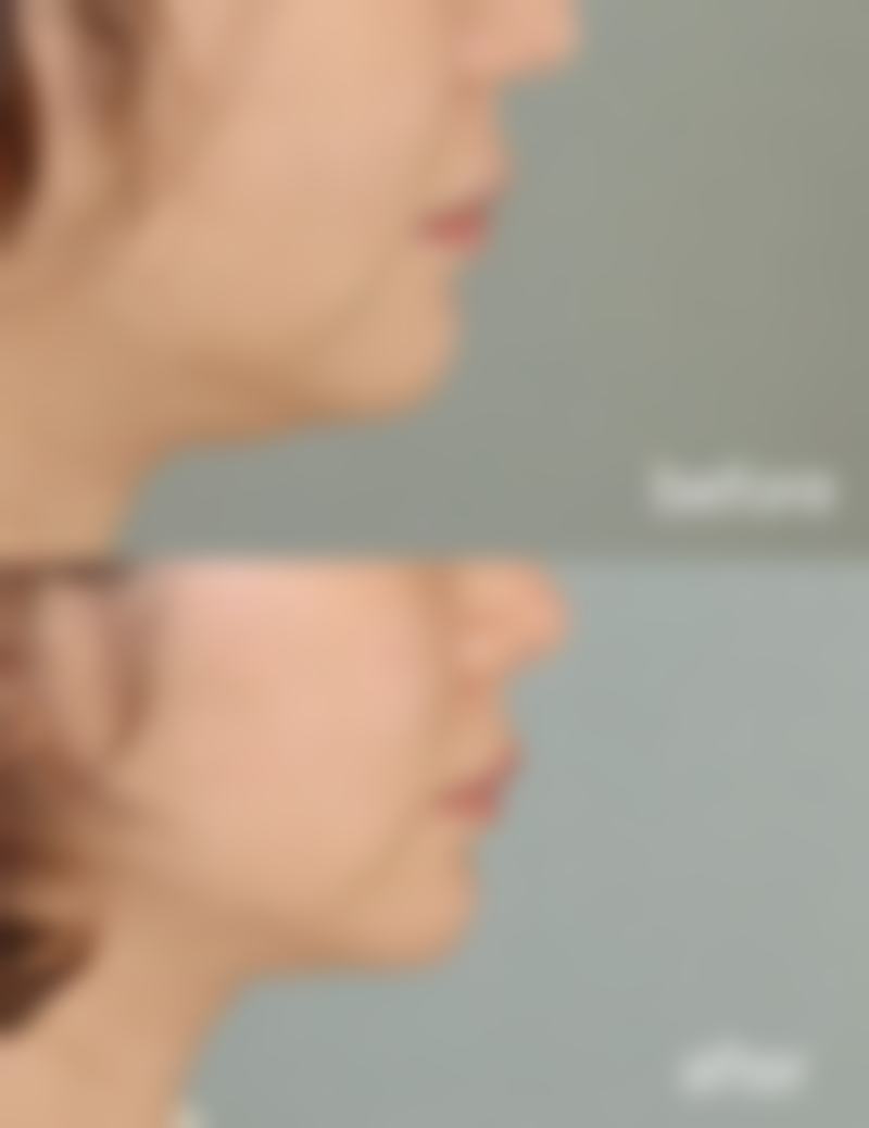 李德延医生的擅长领域