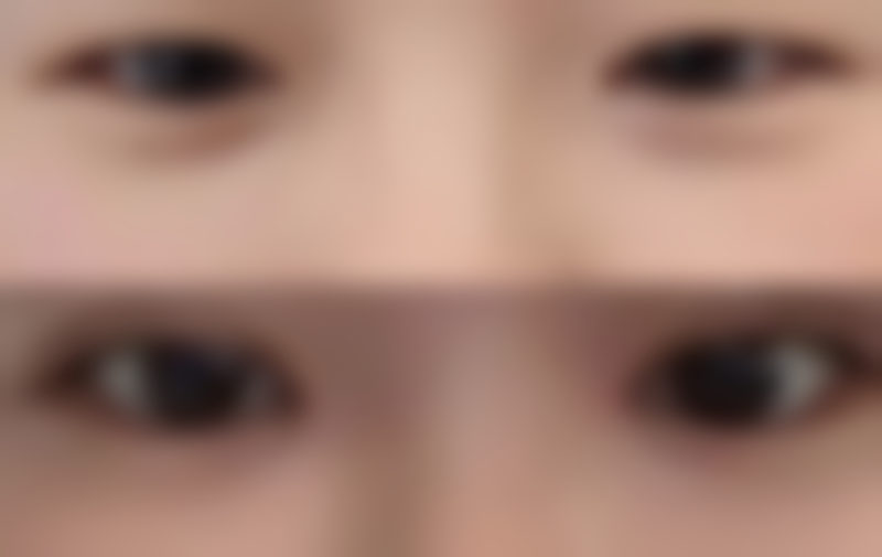 唐山张小熊医疗美容求美者反馈