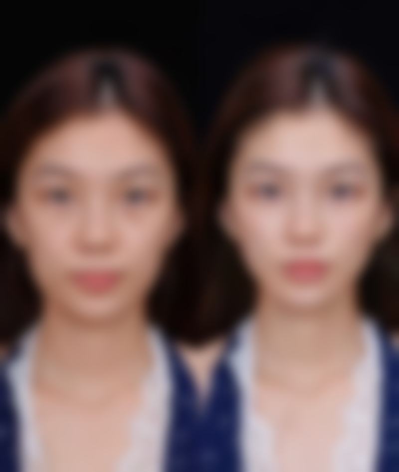 舟山刘静医疗美容诊所价格收费