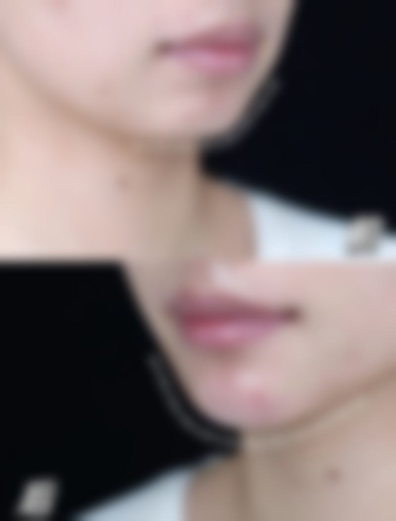 张赫医生的成功实例